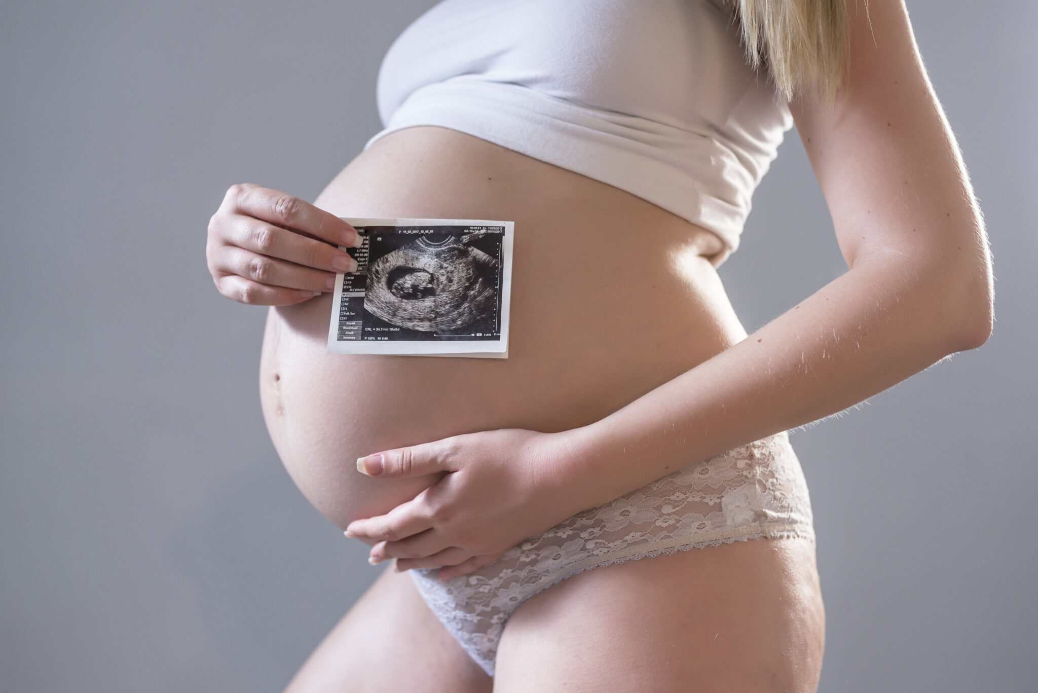 Historie, które krzepią pregnant woman holding an x ray in front of her belly high